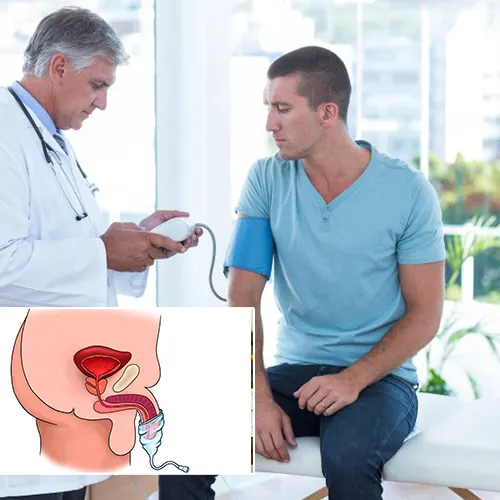 The Emotional and Psychological Benefits of Penile Implants