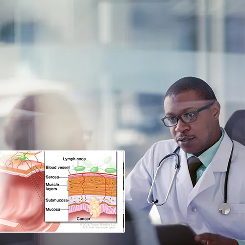 Lifecycle of Your Penile Implant